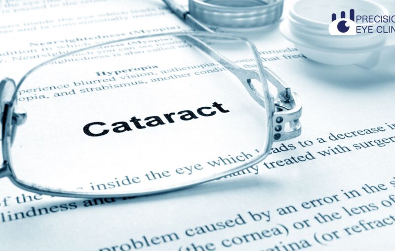 Cataract-eye